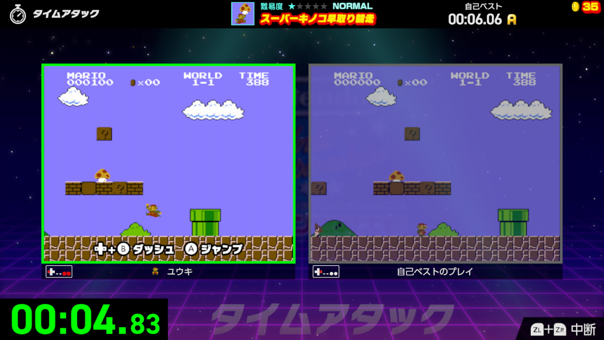 dショッピング |任天堂 ［Switch］ Nintendo World Championships