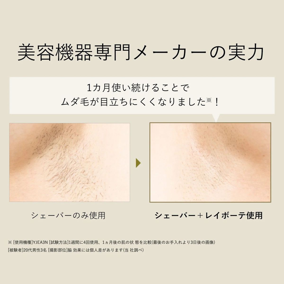 ひかりTVショッピング | YA-MAN 光美容器 レイボーテ クール ひかりTVショッピング | YA-MAN 光美容器 レイボーテ クール